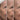 Stronger Is Not Always Better: Why Progressive Skin Treatment Matters